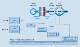 Pulmonary hypertension associated with left heart disease.