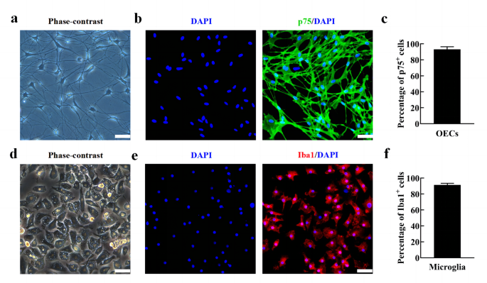 Curcumin-activated Olfactory Ensheathing Cells Improve Functional Recovery After Spinal Cord Injury by Modulating Microglia Polarization Through APOE/TREM2/NF-κB Signaling Pathway.