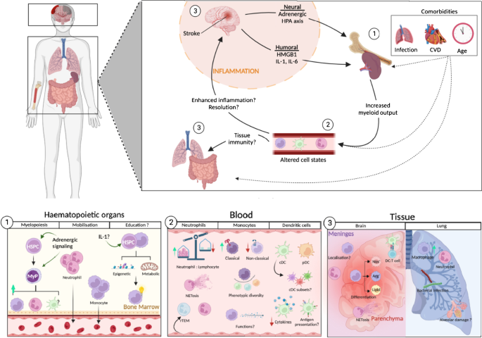 Systemic innate myeloid responses to acute ischaemic and haemorrhagic stroke.