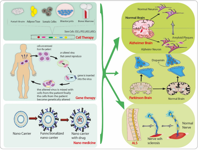 Regenerative medicine improve neurodegenerative diseases.