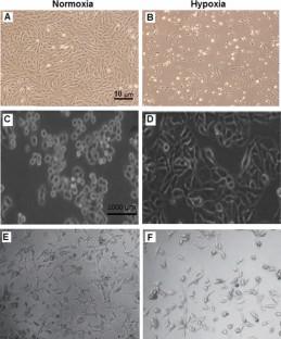 The role of oxygen tension in cell fate and regenerative medicine: implications of hypoxia/hyperoxia and free radicals.