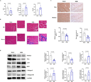 PDZK1 improves ventricular remodeling in hypertensive rats by regulating the stability of the Mas receptor