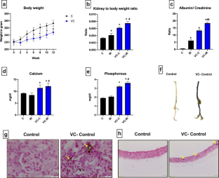 Impaired renal ischemia reperfusion recovery after bilateral renal artery ligation in rats treated with adenine: role of renal mitochondria.