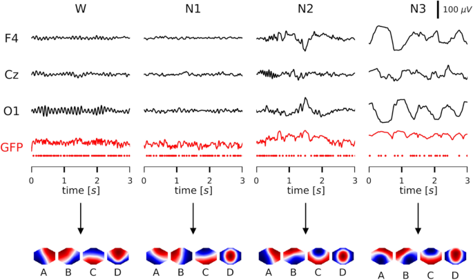 Frequency Analysis of EEG Microstate Sequences in Wakefulness and NREM Sleep.