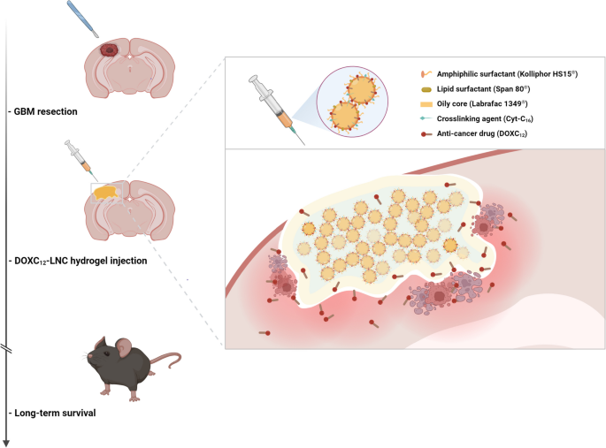 Local delivery of doxorubicin prodrug via lipid nanocapsule-based hydrogel for the treatment of glioblastoma.