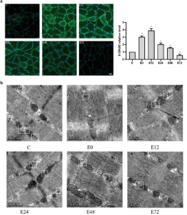 Downhill running induced DNA damage enhances mitochondrial membrane permeability by facilitating ER-mitochondria signaling.