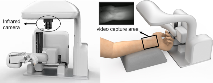 Palpation localization of radial artery based on 3-dimensional convolutional neural networks