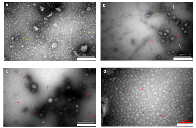 The Effect of Ultrasonication on the Fibrillar/ Oligomeric Structures of Aβ1−42 at Different Concentrations