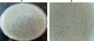 Therapeutics and prophylactic efficacy of novel lytic Escherichia phage vB_EcoS_PJ16 against multidrug-resistant avian pathogenic E. coli using in vivo study.