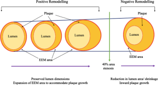 Cardiovascular Profiles of Younger and Older Coronary Artery Disease Patients in Asian and Western Regions