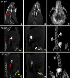 Ioversol Induced Microglia Proinflammatory Activation and Oxidative Stress in Rats.