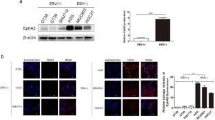 MiR-BART1-3p and BART18-5p inhibit cell migration, proliferation and activate autophagy in Epstein-Barr virus-associated gastric cancer by targeting erythropoietin-producing human hepatocellular 2.