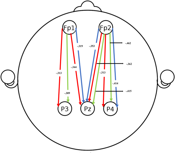 Directional Alpha Frontoparietal Connectivity and Anxiety in Autistic Boys