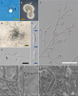 Mitospore formation on pure cultures of Tuber japonicum (Tuberaceae, Pezizales) in vitro