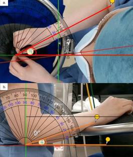 Customization of a passive surgical support robot to specifications for ophthalmic surgery and preliminary evaluation.