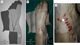 Connection between medial dorsal cutaneous nerve and saphenous nerve: case report.