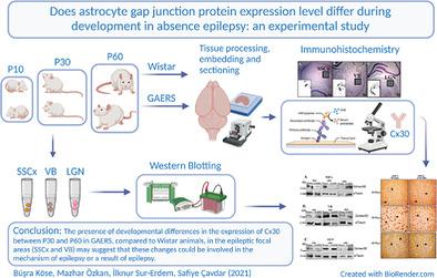 Does astrocyte gap junction protein expression differ during development in absence epileptic rats?