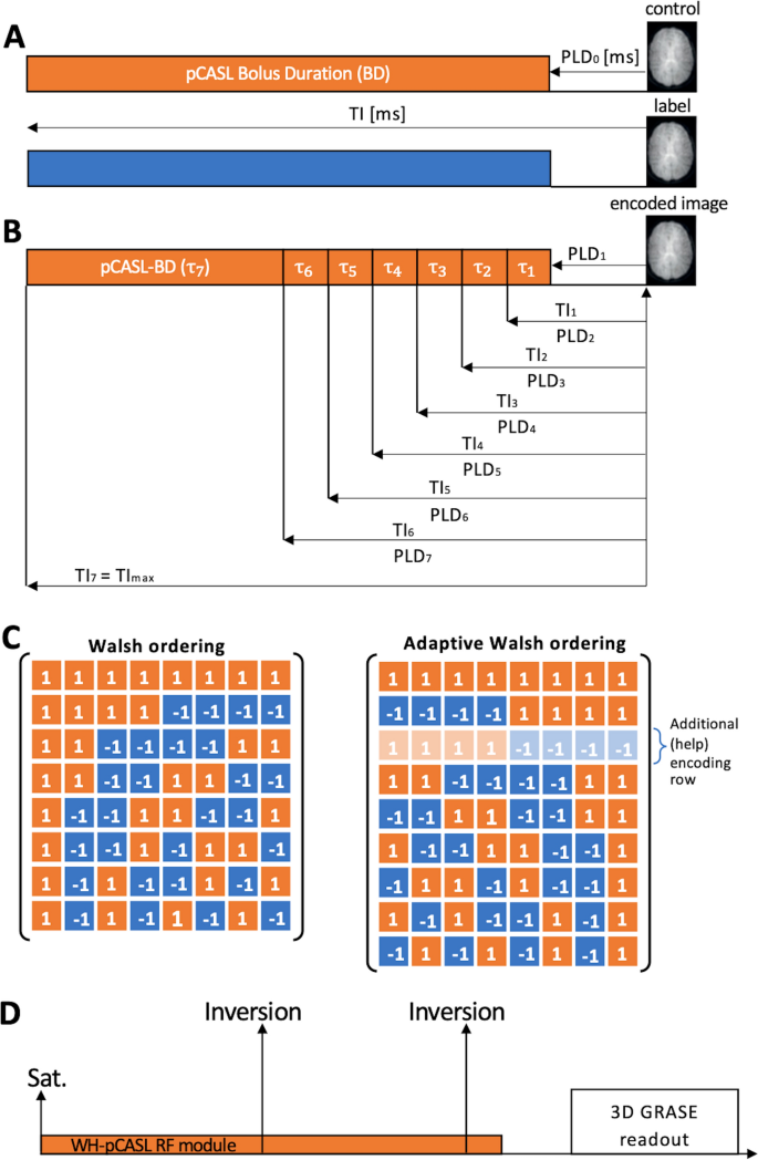 Subject-specific timing adaption in time-encoded arterial spin labeling imaging.