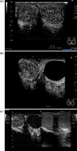 Contrast-enhanced ultrasound findings in testicular torsion and non-testicular torsion.