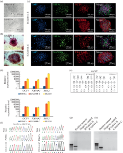 Creation of Induced Pluripotent Stem Cells ICGi044-B and ICGi044-C Using Reprogramming of Peripheral Blood Mononuclear Cells of a Patient with Parkinson’s Disease Associated with c.1492T>G Mutation in the GLUD2 Gene