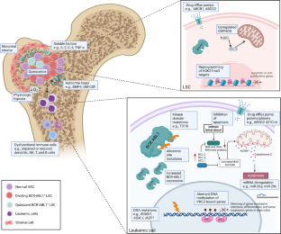 Therapy Resistance and Disease Progression in CML: Mechanistic Links and Therapeutic Strategies.