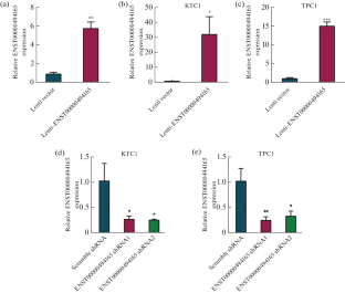 The Long Non-Coding RNA ENST00000494165 Influence Papillary Thyroid Cancer Cell Proliferation and Invasion