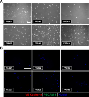 Generation of Autologous Vascular Endothelial Cells for Patients with Peripheral Artery Disease.