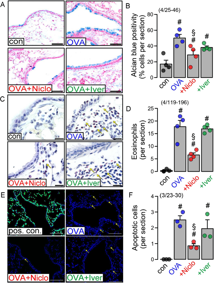 Niclosamide, but not ivermectin, inhibits anoctamin 1 and 6 and attenuates inflammation of the respiratory tract.