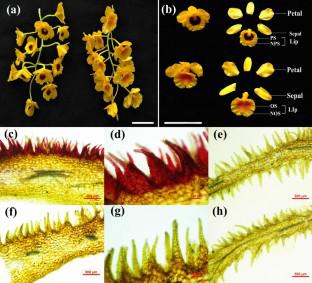 Integrative Metabolomic and Transcriptome Analysis Reveal the Differential Mechanisms of Spot Color in the Lips of Dendrobium chrysotoxum