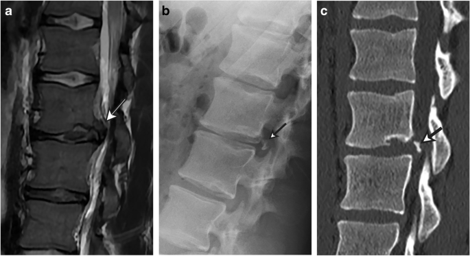 Bone radiographs: sometimes overlooked, often difficult to read, and still important.