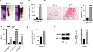 CREB1 Silencing Protects Against Inflammatory Response in Rats with Deep Vein Thrombosis Through Reducing RPL9 Expression and Blocking NF-κB Signaling.