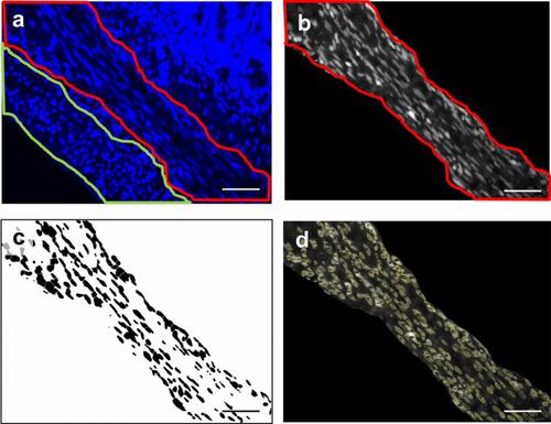 Muscle hypertrophy and neuroplasticity in the small bowel in short bowel syndrome.