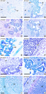 Gametophytic self-incompatibility in Maxillariinae orchids.