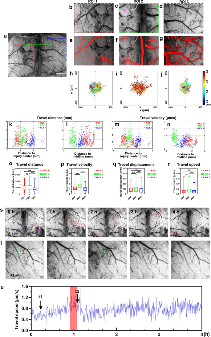 A Through-Intact-Skull (TIS) chronic window technique for cortical structure and function observation in mice