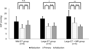 Intraocular pressure changes at different gaze positions after superior rectus muscle-lateral rectus muscle loop myopexy in highly myopic strabismus.