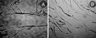 Molecular Self-Assembly as a Trigger of Life Origin and Development