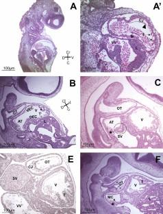 Developmental heart morphology in the Amazon turtle Podocnemis expansa (Testudines: Podocnemidae)