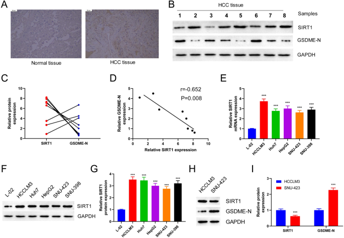 SIRT1 Inhibition-Induced Mitochondrial Damage Promotes GSDME-Dependent Pyroptosis in Hepatocellular Carcinoma Cells.