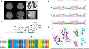 Lethal variant in the C2A domain may cause severe SYT1-associated neurodevelopmental disorder in the newborns.