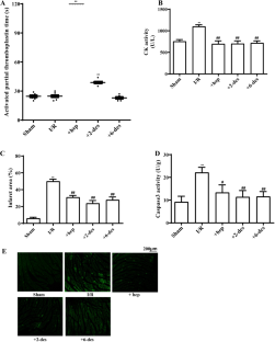 6-O-desulfated heparin attenuates myocardial ischemia/reperfusion injury in mice through the regulation of miR-199a-5p/klotho axis.