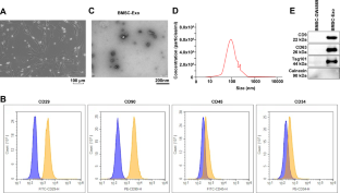 Chondroprotective effects of bone marrow mesenchymal stem cell-derived exosomes in osteoarthritis.