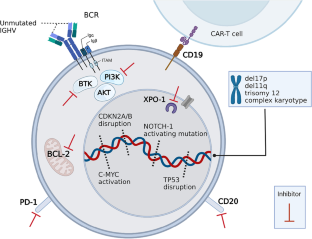 Richter Transformation of Chronic Lymphocytic Leukemia-Are We Making Progress?