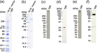 Dynamics of serum IgM level during the growth of juvenile Japanese amberjack Seriola quinqueradiata