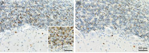 Poly-GA immunohistochemistry is a reliable tool for detecting C9orf72 hexanucleotide repeat expansions