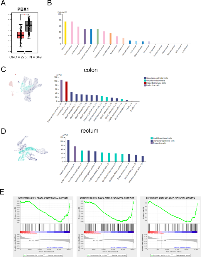 Spindle function and Wnt pathway inhibition by PBX1 to suppress tumor progression via downregulating DCDC2 in colorectal cancer.