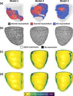 Optogenetic Modulation of Arrhythmia Triggers: Proof-of-Concept from Computational Modeling.