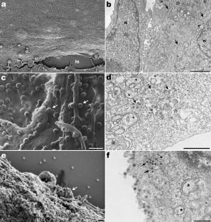 SARS-CoV-2 egress from Vero cells: a morphological approach.