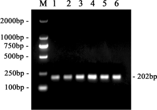 A recombinase polymerase amplification-SYBR Green I assay for the rapid and visual detection of Brucella.