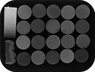 Radiopacity evaluation of different types of resin restorative materials using a digital radiography system.