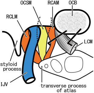 Rectus capitis lateralis muscle revisited: a histological study using human fetuses.